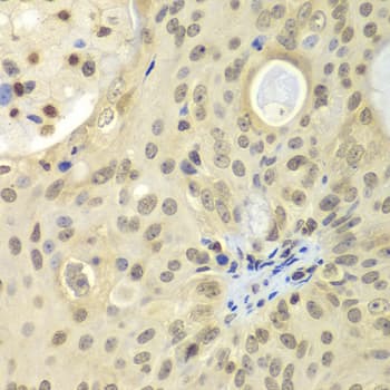ULK4 Antibody