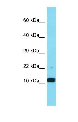 FAM25A Antibody (aa22-71)