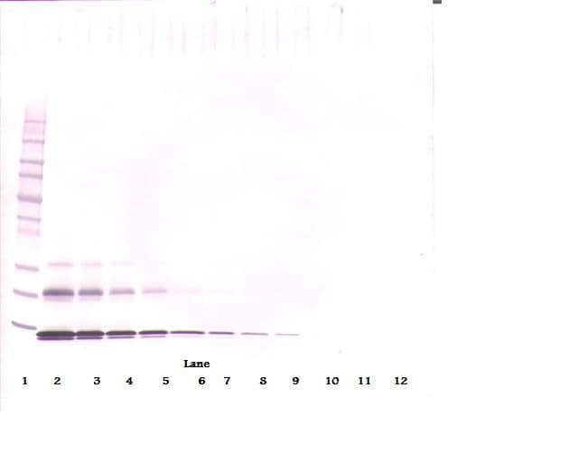 Monoclonal Mouse anti-Human CCL16 / LEC Antibody (WB)