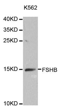 Polyclonal Rabbit anti-Human FSHB / FSH Beta Antibody (IHC, WB)