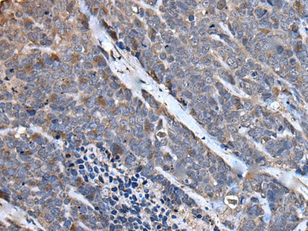 Polyclonal Rabbit anti-Human MCM10 Antibody (IHC)