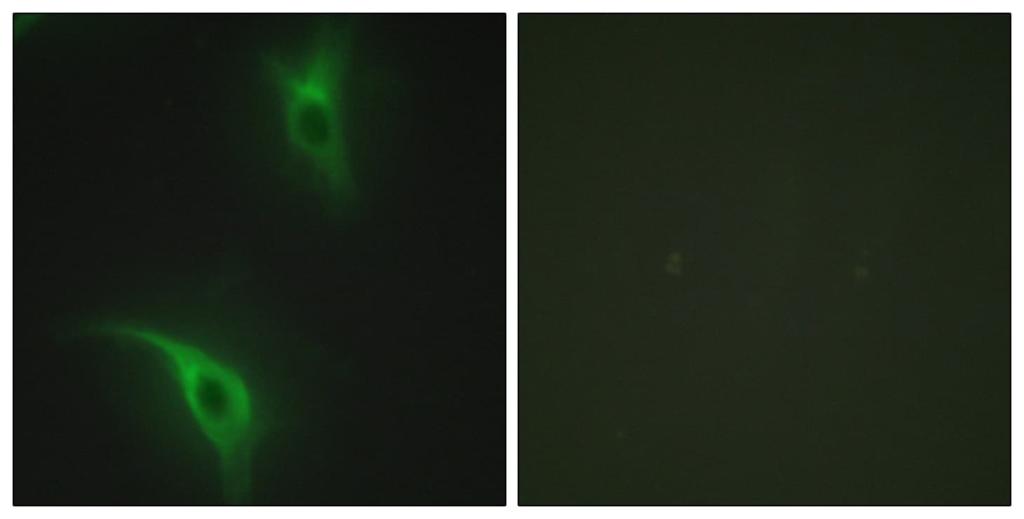 Polyclonal Rabbit anti-Human CKS1B / CKS1 Antibody (aa10-59, IF, WB)