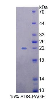 Human EEF1E1 / AIMP3 Protein (Recombinant His-T7, N-terminus)