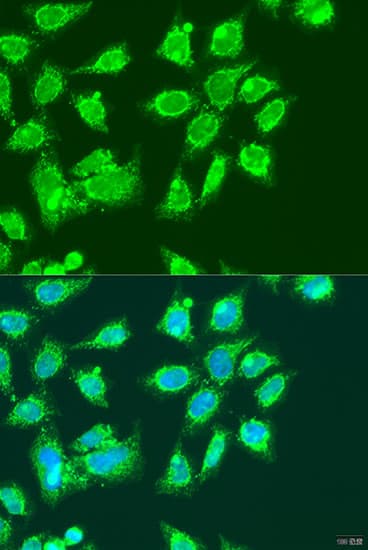 MCCC2 / MCCB Antibody