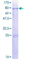 Human CYP2C8 Protein (Recombinant GST)