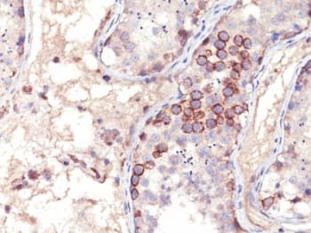 MAGEA1 / MAGE 1 Antibody (clone MA454, Ready-to-Use)