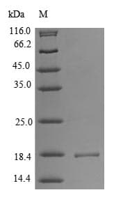 Human ACP1 / Acid Phosphatase Protein (Recombinant)