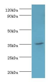 Polyclonal Rabbit anti-Human SULT1C2 / Sulfotransferase 1C2 Antibody (aa1-120, WB)