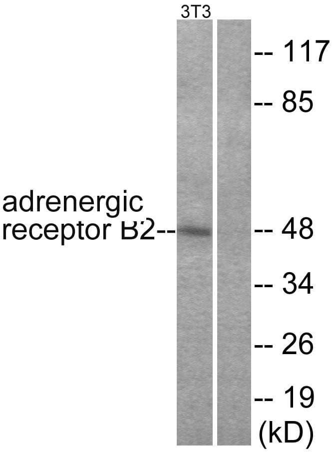 ADRB2 Antibody (p346)