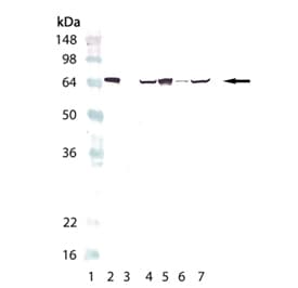 Heat Shock Protein 70 / HSPA1A Antibody (clone C92F3A-5)