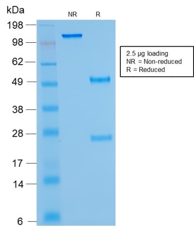 Kappa Light Chain Antibody (clone rKLC264)