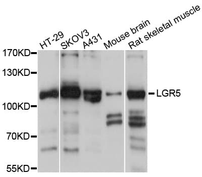 Polyclonal Rabbit anti-Human GPR49 / LGR5 Antibody (WB)