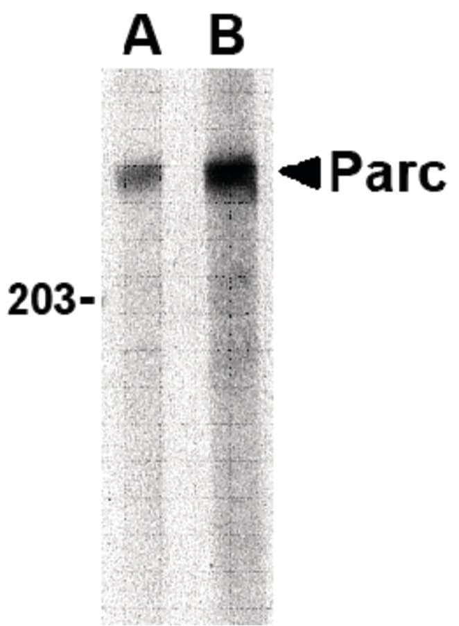 IHC-plus™ CUL9 / Cullin 9 Antibody