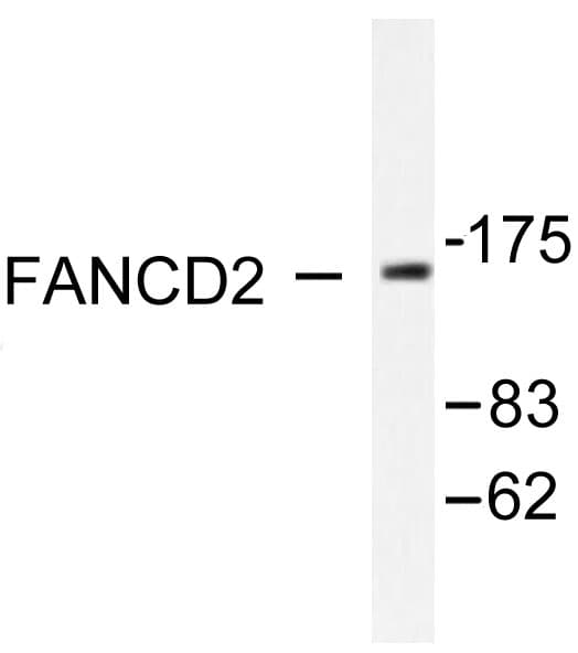Polyclonal Rabbit anti-Human FANCD2 Antibody (Pro216, IHC, WB)