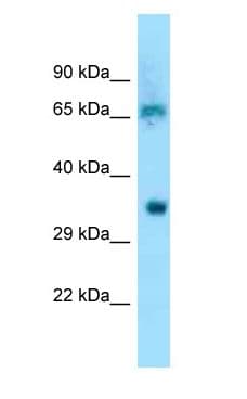 EIF3D Antibody (N-Terminus)