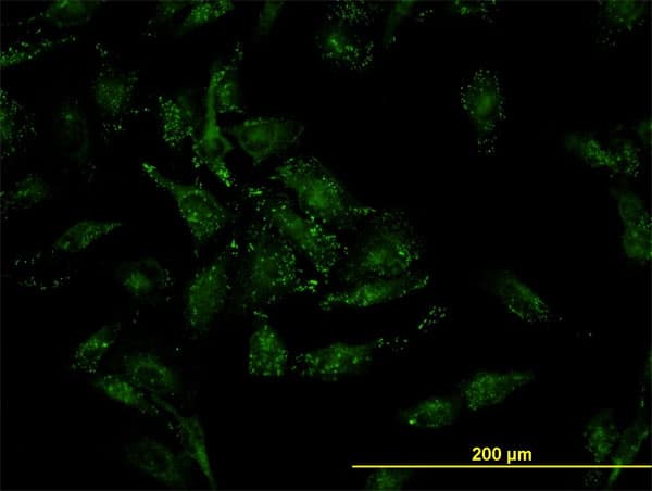 CFL2 / Cofilin 2 Antibody (clone 6G9)