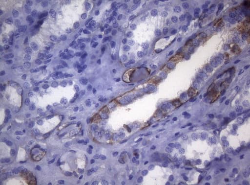 LGALS3 / Galectin 3 Antibody (clone OTI8E3)