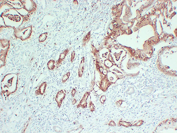 S100P Antibody (clone ABT-S100P)