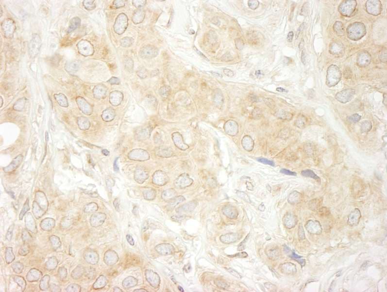Polyclonal Rabbit anti-Human DDX19B Antibody (aa450-C-term, IHC, WB)