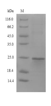 Mouse SDF2L1 Protein (Recombinant 6His, N-terminus + Myc, C-terminus)