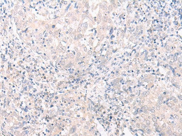 Polyclonal Rabbit anti-Human SLC25A27 / UCP4 Antibody (IHC, WB)