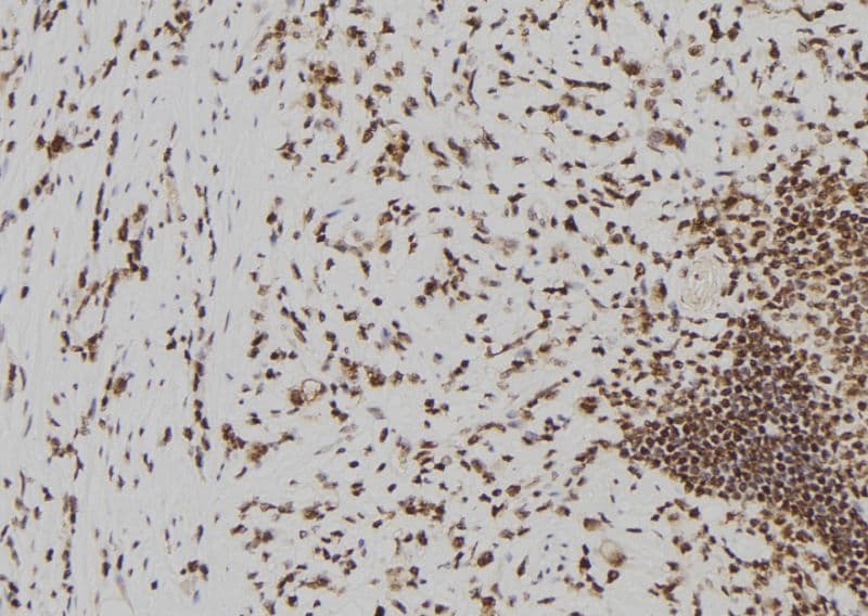 Polyclonal Rabbit anti-Human BECN2 Antibody (IHC, WB)