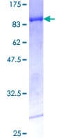 Human RARG / RAR-Gamma Protein (Recombinant GST)