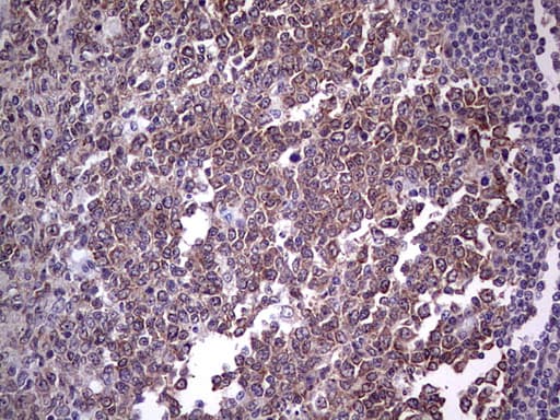 Monoclonal Mouse anti-Human TLK2 Antibody (clone OTI3F2, aa1-296, IHC, WB)
