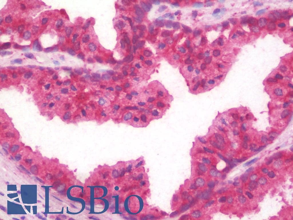 IHC-plus™ Monoclonal Mouse anti-Human BMPR2 Antibody (clone 3F6, IHC, IF, WB)
