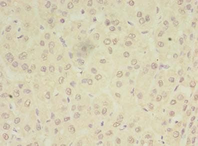 PEX11B Antibody