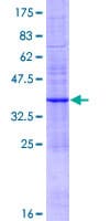 Human ABCC6 / MRP6 Protein (Recombinant GST)