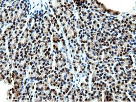 NT5DC1 Antibody (clone OTI3H2)