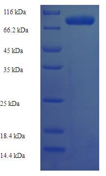 Human RAVER2 Protein (Recombinant His-SUMO)