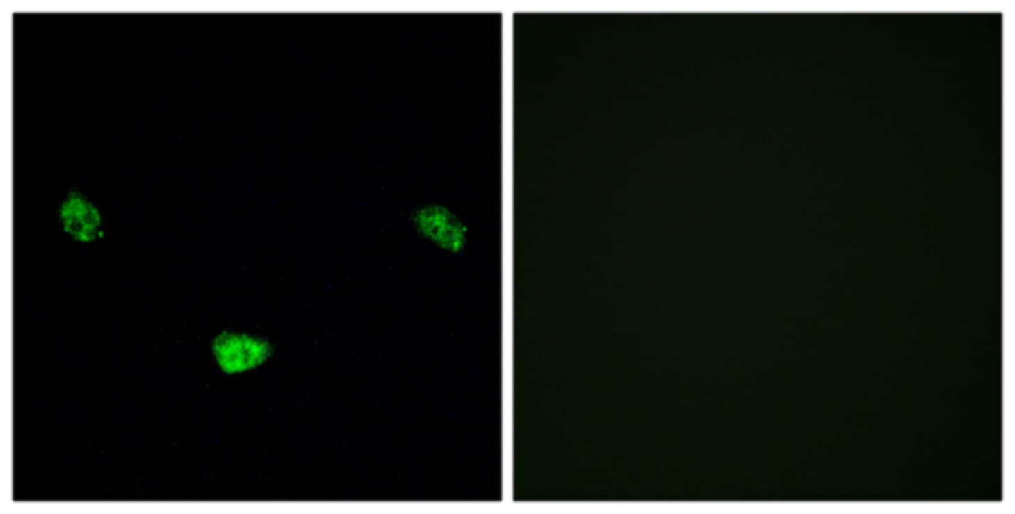 HNF4A / HNF4 Antibody (phospho-Ser313)