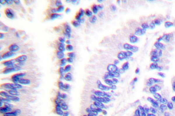 Polyclonal Rabbit anti-Human FADD Antibody (Asn188, IHC, WB)