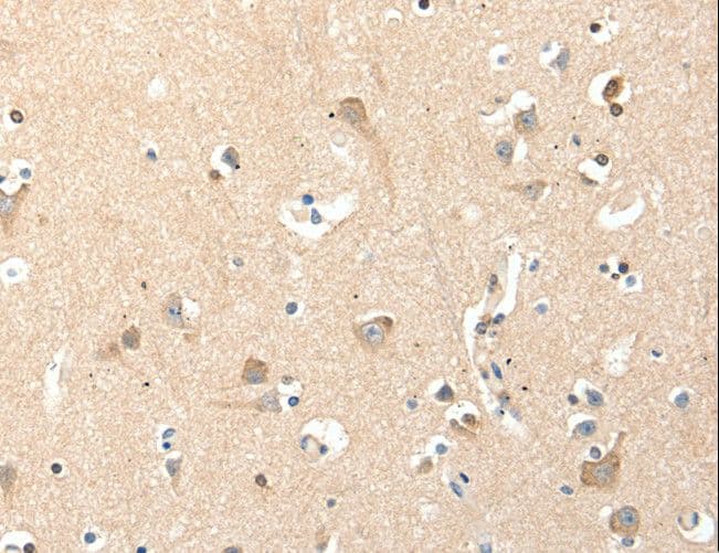 RRAD Antibody