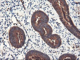 PFKP Antibody (clone OTI2E8, Carrier-free)