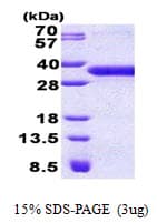Human YAE1D1 Protein (Recombinant His)
