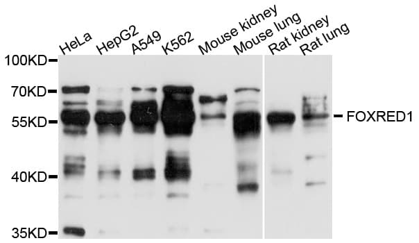 FOXRED1 Antibody