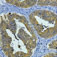 PathPlus™ KRT8 / CK8 / Cytokeratin 8 Antibody