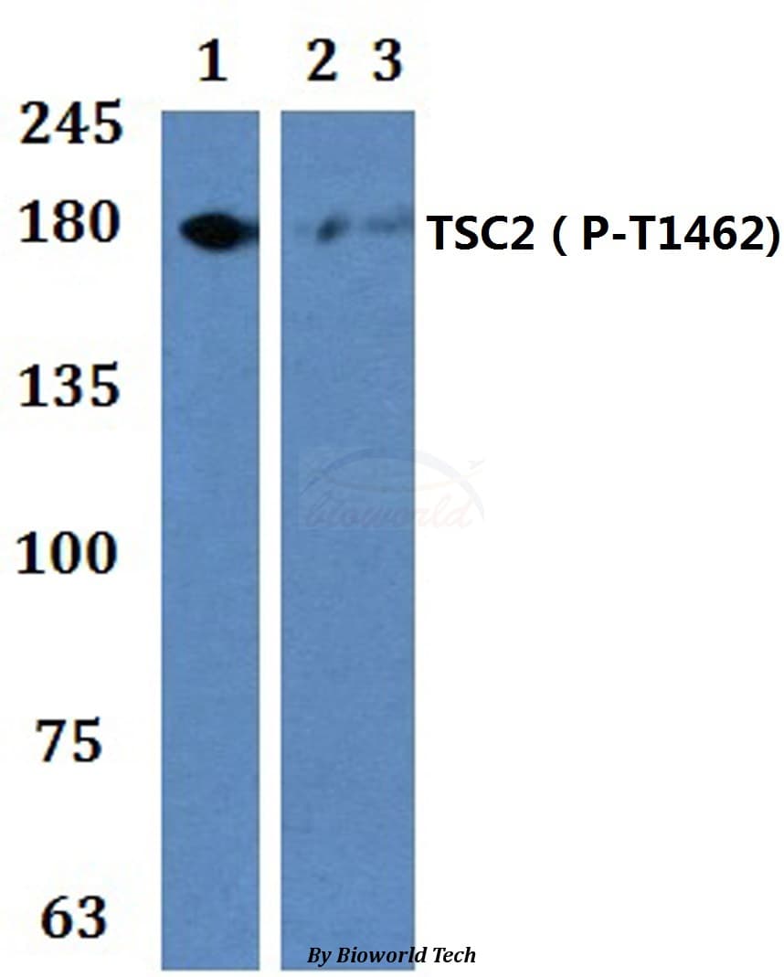Tuberin / TSC2 Antibody (phospho-Thr1462)