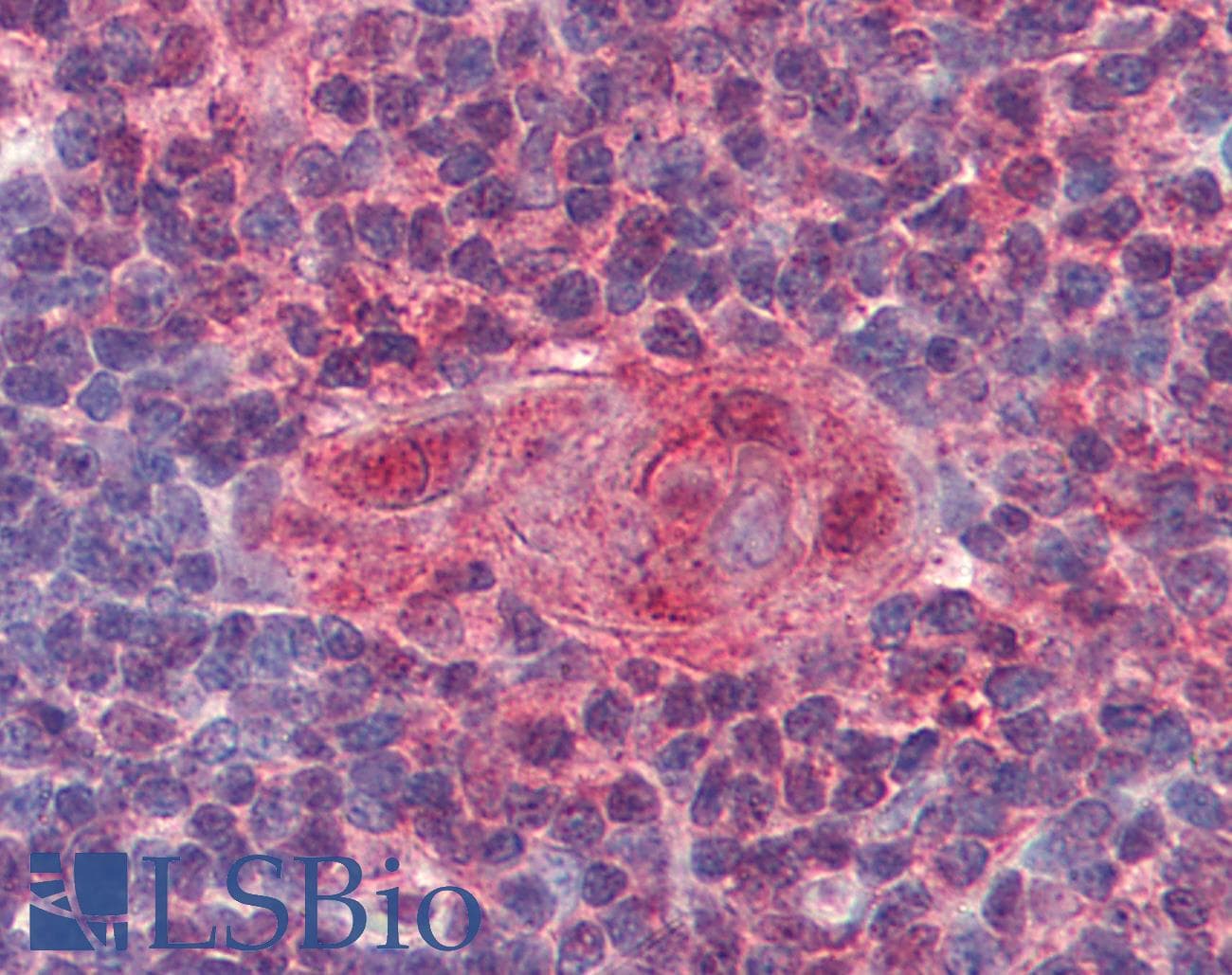 IHC-plus™ Monoclonal Mouse anti-Human UNG / Uracil DNA Glycosylase Antibody (clone K1C12, aa1-313, IHC, WB)