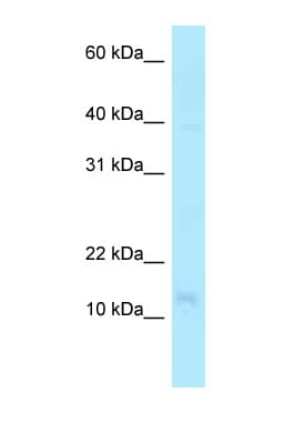 Polyclonal Rabbit anti-Human PFDN4 Antibody (N-Terminus, WB)