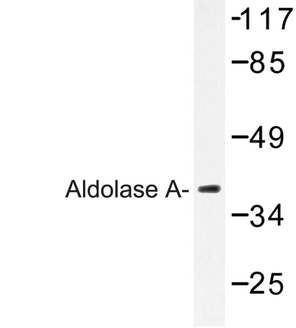 ALDOA / Aldolase A Antibody (Thr9)