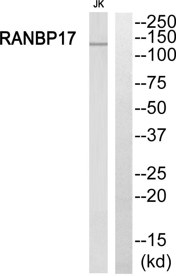 RANBP17 Antibody