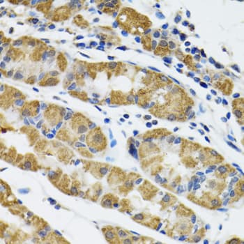 HAPLN1 Antibody