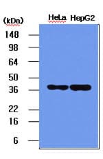 IHC-plus™ NPM1 / NPM / Nucleophosmin Antibody (aa81-294, clone 5E3)