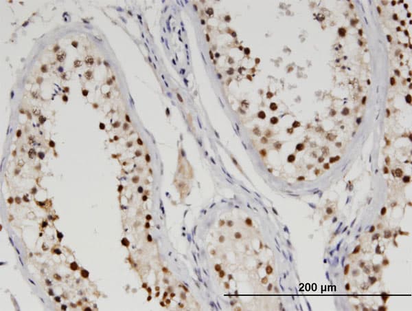 TDP2 / TTRAP Antibody (clone 3D11)