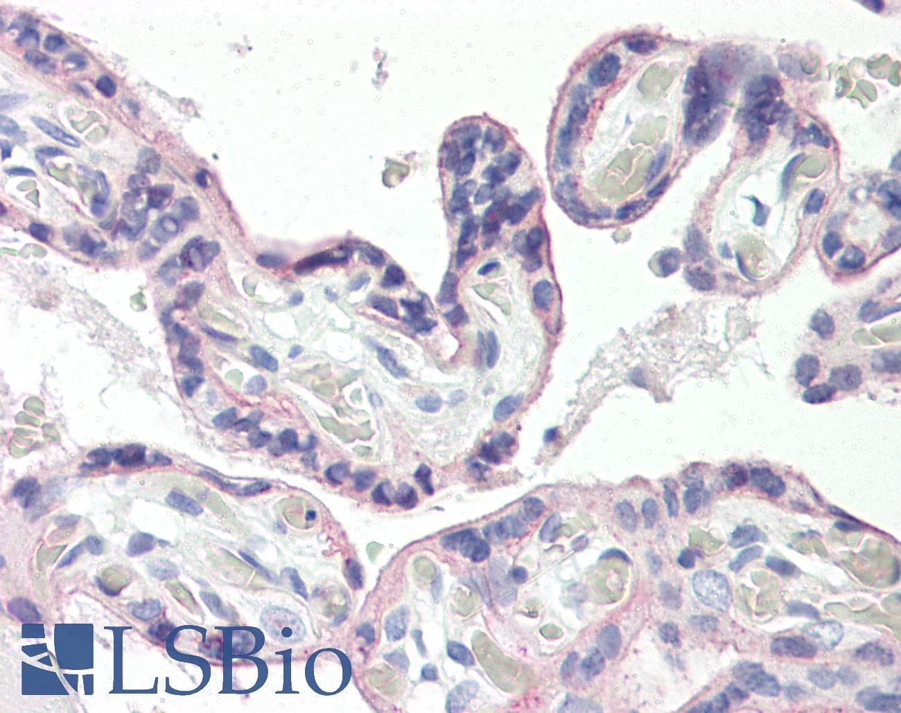 IHC-plus™ SLC2A1 / GLUT-1 Antibody (aa441-490)