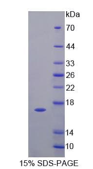 Mouse I-BABP / FABP6 Protein (Recombinant His-S)